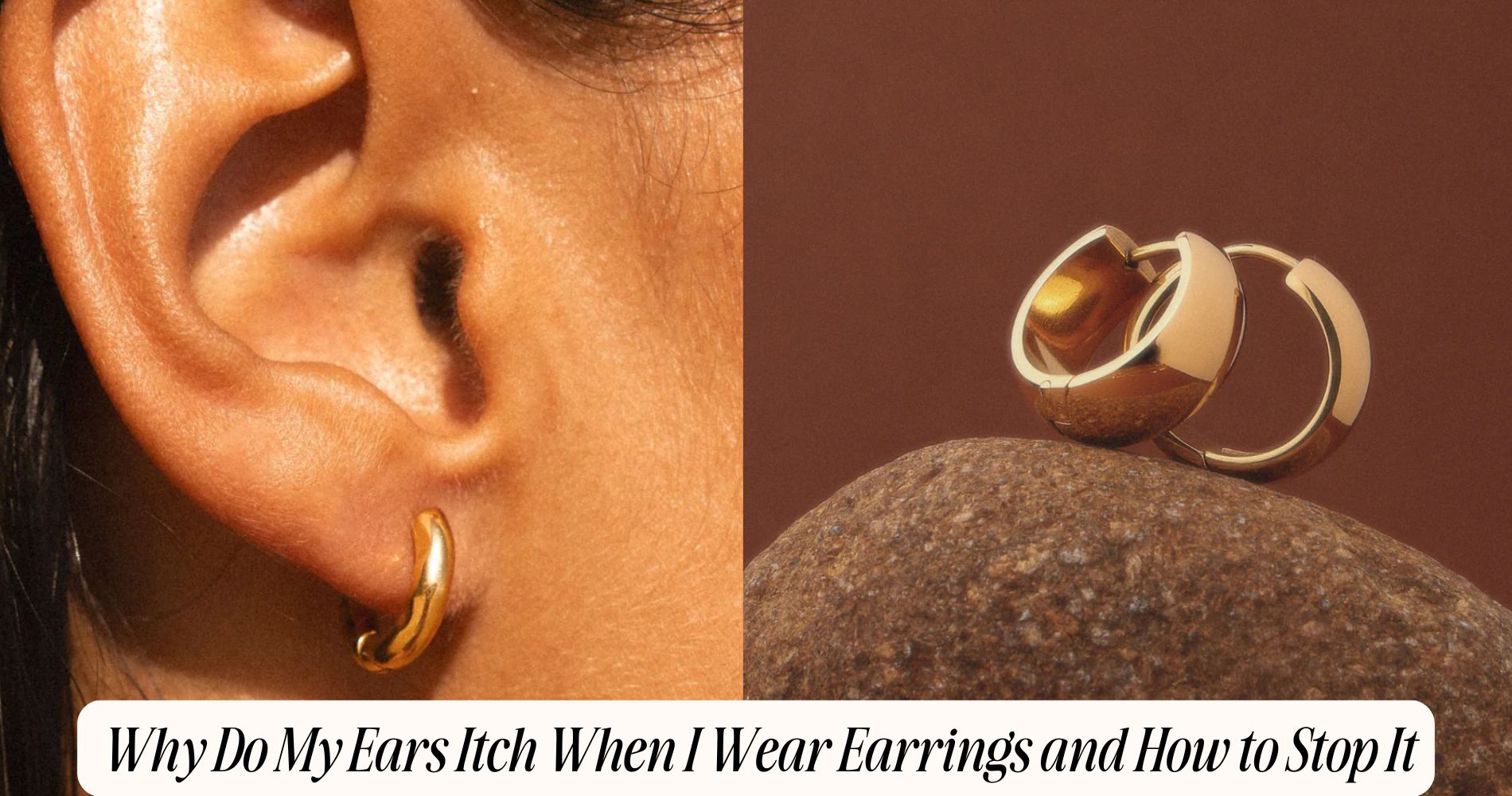 why do my ears itch when i wear earrings​